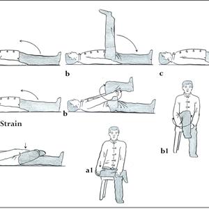 Pseudo Sciatica Gluteus Minimus - Top 7 Tips To Treat And Prevent Sciatica