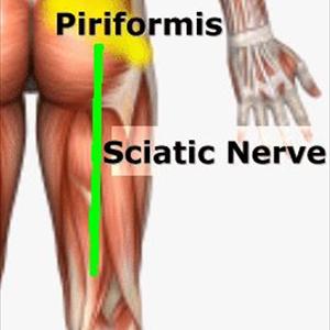 Sciatic Neuralgia Symptoms 