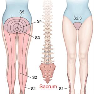 Sciatica Symptoms Buttocks 