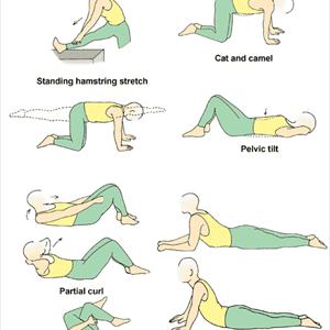 Sciatic Nerve Neuropathy Blog - Easy Sciatica Exercises