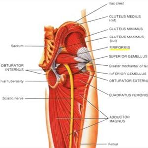 Treating Sciatic Nerve Pain - Ischias: Sciatic Nerve Or Sciatica