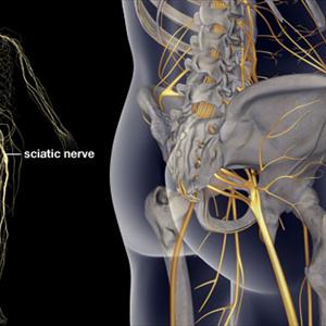 Sciatica Arm - Sciatica Stretches And Information