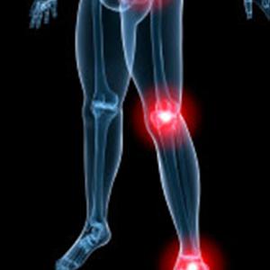 Cause Of Sciatica Leg Pain 