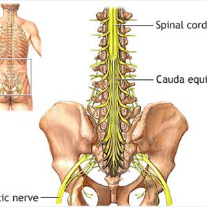 Sciatica Mri - What Are The 3 Best Exercises For Sciatica?