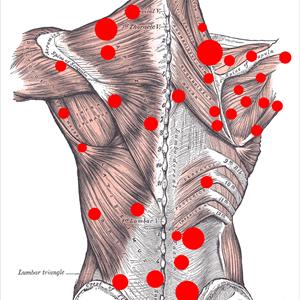  Stop Your Sciatica ... Now!